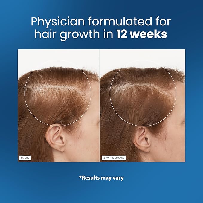 Easy Roll On Hair Growth Serum